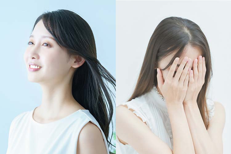双極性障害のイメージ画像